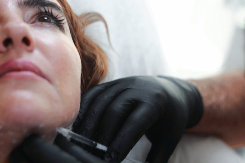 Mésothérapie et microneedling Close-up of a woman receiving dermal filler injection by professional in black gloves.