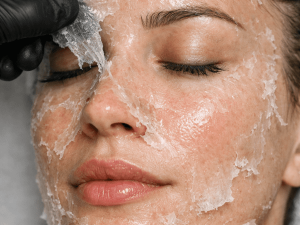 peeling