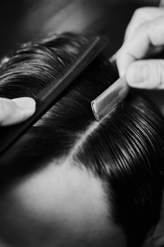 alopécie, chute de cheveux
