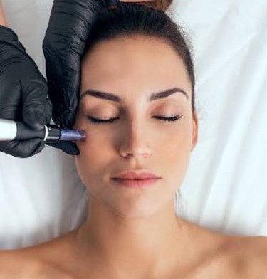 séance de microneedling avec Dermapen